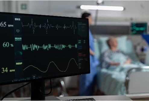 EKG/ECG (Electrocardiogram)